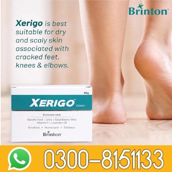 Xerigo Cream 50gm In Pakistan